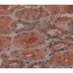 Retinol Binding Protein 5, Cellular (RBP5) Antibody