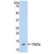 Western blot analysis of recombinant Human S100A10.