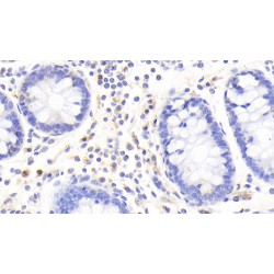 S100 Calcium Binding Protein A12 (S100A12) Antibody