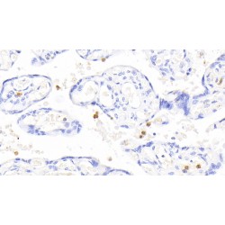 S100 Calcium Binding Protein A12 (S100A12) Antibody