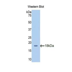 Amino Acid Transporter Heavy Chain SLC3A2 (SLC3A2) Antibody