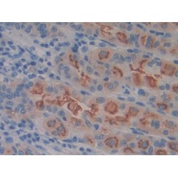 Amino Acid Transporter Heavy Chain SLC3A2 (SLC3A2) Antibody
