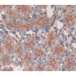 Amino Acid Transporter Heavy Chain SLC3A2 (SLC3A2) Antibody