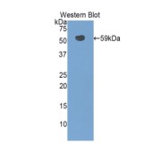 Western blot analysis of the recombinant protein.