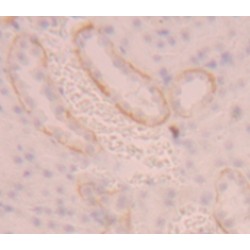 4F2 Cell-Surface Antigen Heavy Chain (SLC3A2) Antibody