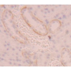 Amino Acid Transporter Heavy Chain SLC3A2 (SLC3A2) Antibody