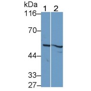 Western blot analysis of (1) DU145 cell lysates, and (2) MCF7 cell lysates, using Rabbit Anti-Human TMPRSS2 Antibody (0.2 µg/ml) and HRP-conjugated Goat Anti-Rabbit antibody (<a href="https://www.abbexa.com/index.php?route=product/search&amp;search=abx400043" target="_blank">abx400043</a>, 0.2 µg/ml).