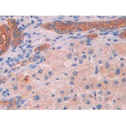 Mitochondrial Uncoupling Protein 2 (UCP2) Antibody