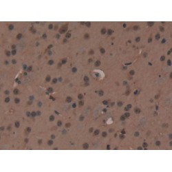 X-Ray Repair Cross Complementing 6 (XRCC6) Antibody