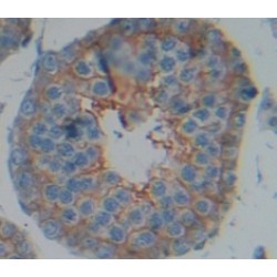 A Disintegrin And Metalloprotease 5 (ADAM5) Antibody