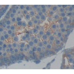 A Disintegrin And Metalloprotease 6 (ADAM6) Antibody