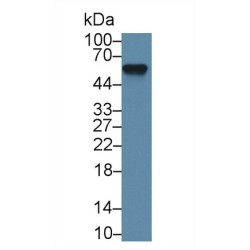 Alpha-2-Heremans Schmid Glycoprotein (AHSG) Antibody