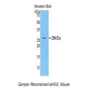 Western blot analysis of recombinant Mouse aHSG.