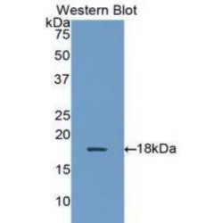 Alpha-Hemoglobin Stabilizing Protein (aHSP) Antibody