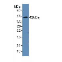 Alpha-Hemoglobin Stabilizing Protein (aHSP) Antibody