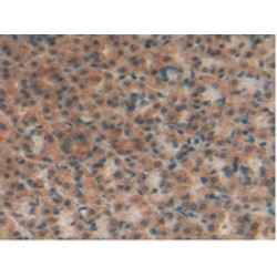 Alpha-Hemoglobin Stabilizing Protein (aHSP) Antibody