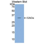 abx103799