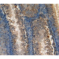 Serine/Threonine-Protein Kinase LMTK1 (AATK) Antibody