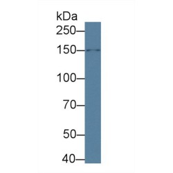 Mitogen-Activated Protein Kinase Kinase Kinase 5 (MAP3K5) Antibody