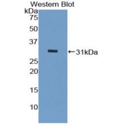 Mitogen-Activated Protein Kinase Kinase Kinase 5 (MAP3K5) Antibody
