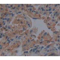 ATP Binding Cassette Subfamily G Member 1 (ABCG1) Antibody