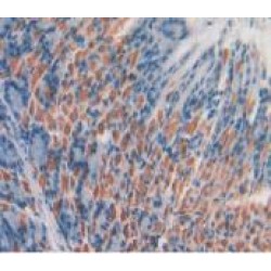 Atypical Chemokine Receptor 1 (ACKR1) Antibody