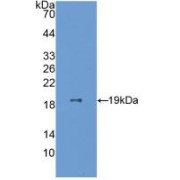 Western blot analysis of recombinant Human ESM1.