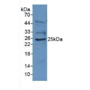 Western blot analysis of Human Jurkat Cells.