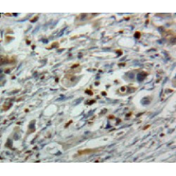 Epstein Barr Virus Induced Protein 3 (EBI3) Antibody