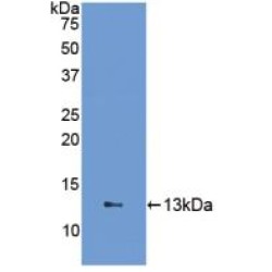 Fatty Acid Binding Protein 1, Liver (FABP1) Antibody