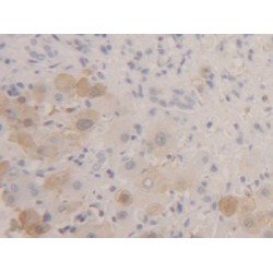 Fatty Acid Binding Protein 1, Liver (FABP1) Antibody