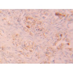 Fibroblast Growth Factor Receptor 1 (FGFR1) Antibody