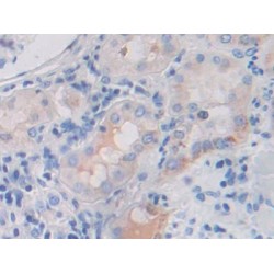 Fibroblast Growth Factor Receptor 3 (FGFR3) Antibody