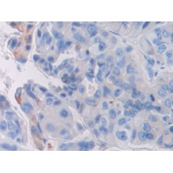 Fibroblast Growth Factor Receptor 3 (FGFR3) Antibody