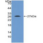 Western blot analysis of recombinant Human FGFR4.