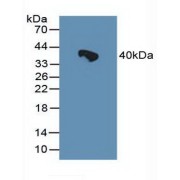 Western blot analysis of Rat Serum.