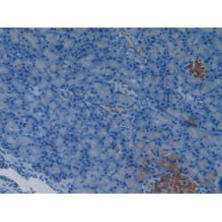 Heat Shock 70 kDa Binding Protein 1 (HSPBP1) Antibody