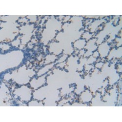 Heat Shock 70 kDa Binding Protein 1 (HSPBP1) Antibody