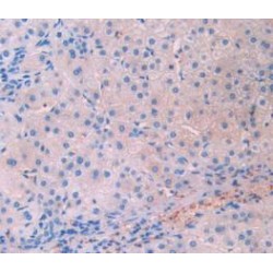 Lecithin Cholesterol Acyltransferase (LCAT) Antibody