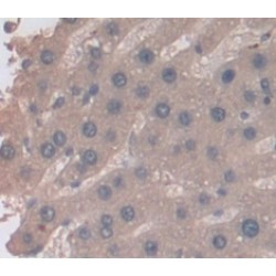 Leukocyte Cell Derived Chemotaxin 2 (LECT2) Antibody