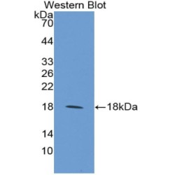 Microfibrillar Associated Protein 5 (MFAP5) Antibody