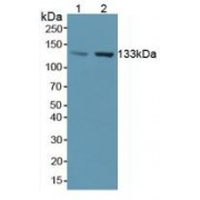 Western blot analysis of (1) Human Liver Tissue and (2) Human Placenta Tissue.
