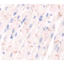 Nitric Oxide Synthase, Endothelial (NOS3) Antibody