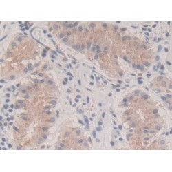 Parathyroid Hormone-Related Protein / PTHrP (PTHLH) Antibody