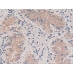 Parathyroid Hormone-Related Protein / PTHrP (PTHLH) Antibody