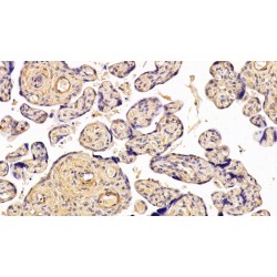 Parathyroid Hormone-Related Protein / PTHrP (PTHLH) Antibody