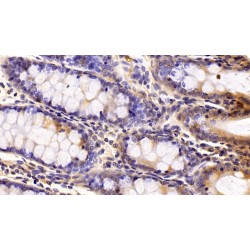 Parathyroid Hormone-Related Protein / PTHrP (PTHLH) Antibody