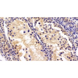 Parathyroid Hormone-Related Protein / PTHrP (PTHLH) Antibody