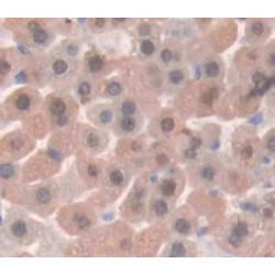 Parathyroid Hormone-Related Protein / PTHrP (PTHLH) Antibody