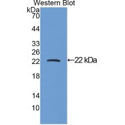 Western blot analysis of the recombinant protein.